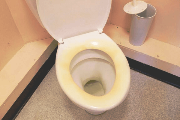 what-causes-yellow-stains-on-toilet-seat-updated-august-2022